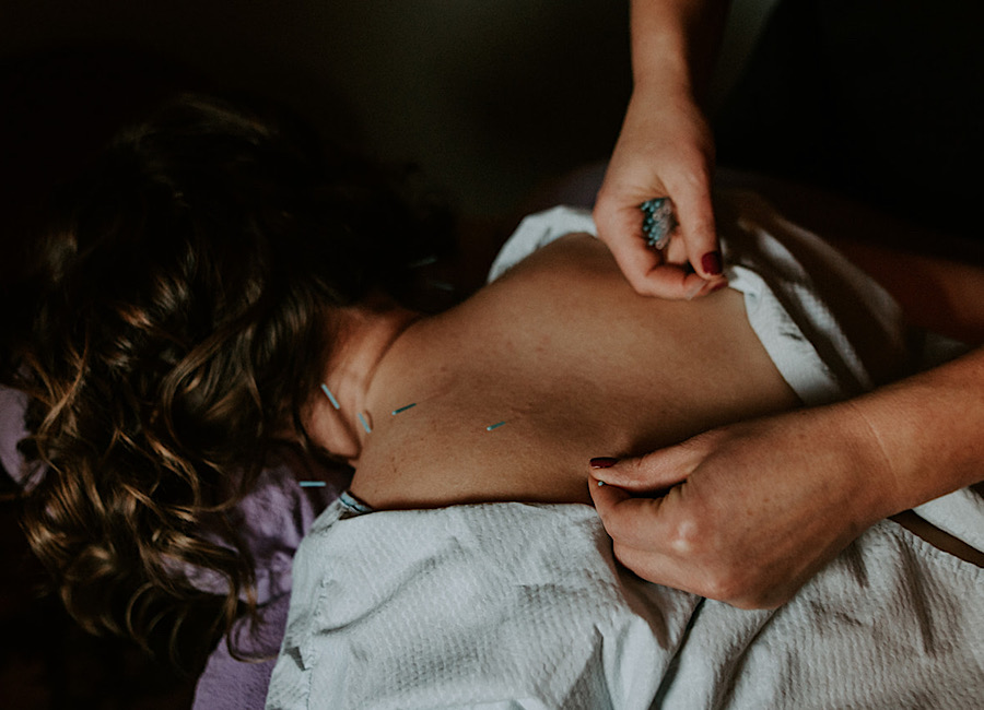 Acupuncture at Natural Elements Health Center with Dr. Christine Schlenker